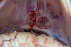 holoprosencefalia-alobar-patologia-2005-003