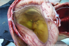 holoprosencefalia-alobar-patologia-2005-007
