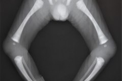 huesos-largos-rx-normales-003