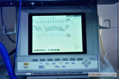 incubadoras-ventiladores-monitores-1999-001