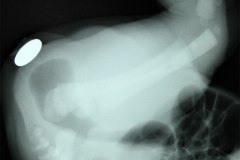 invertograma-malformacion-anorectal-mar-1982-000
