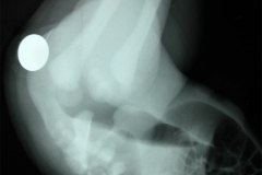 invertograma-malformacion-anorectal-mar-1982-001