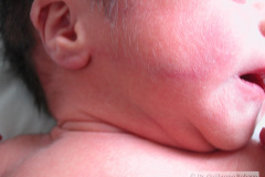 lanugo-facial-2009-001