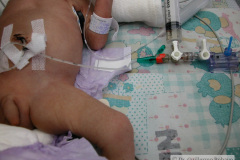 linea-arterial-umbilical-2002_06_21-001