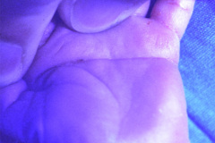 linea-palmar-unica-000
