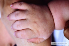 linea-palmar-unica-002