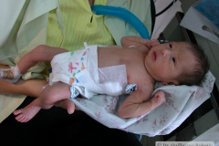 madre-participante-postop-ductus-arterial-1m-20d-2003-003