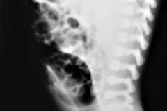 malformacion-ano-rectal-mar-fistula-recto-vesical-1985-004
