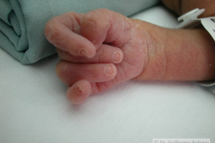 mano-empunada-dedos-imbricados-000