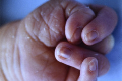 mano-trisomica-bil-000
