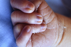 mano-trisomica-bil-001