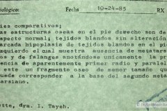 meromelia-defecto-longitudinal-pre-y-post-axial-pie-izq-1985-001