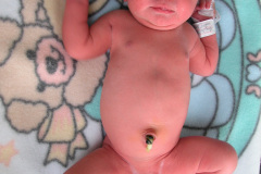 miliaria-cristalina-2006-004