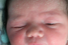 miliaria-cristalina-2006-008
