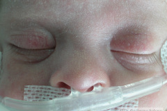 milio-millium-nasal-000