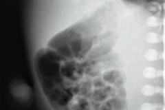 munon-umbilical-1999-001