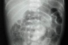 munon-umbilical-1999-002
