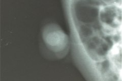 munon-umbilical-1999-003