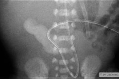 munon-umbilical-2004-001