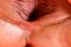 neovagina-por-agenesia-pene-conversion-genital-masc-a-fem-1989-000