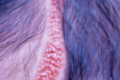 nevus-no-melanocitico-sebaseo-de-jadassohn-graso-001