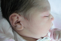 nevus-no-melanocitico-sebaseo-de-jadassohn-suprauricular-2005-004