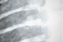 nucleos-esternonles-001