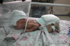 oxigenoterapia-camara-cefalica-en-prono-2003-001