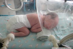oxigenoterapia-camara-cefalica-posicion-prona-2003-001