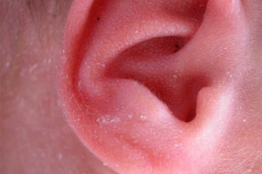 pabellon-auricular-2002-002