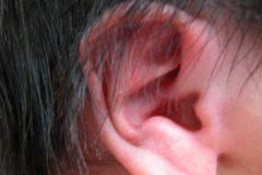 pabellon-auricular-2002-004