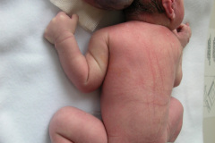 pentalogia-cantrell-2005-011