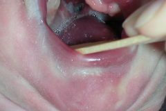 pentalogia-cantrell-2005-014