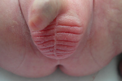 pentalogia-cantrell-2005-023