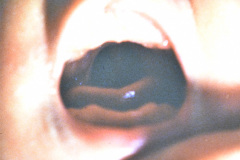 pierre-robin-1986-007