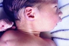 pierre-robin-1989-004