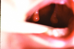pierre-robin-1998-010