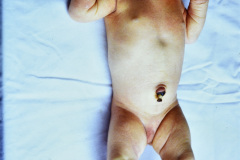 pierre-robin-secuencia-002