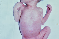 pretermino-1983_10_31-006