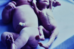 pretermino-1983_10_31-012