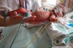 pretermino-003