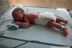 prono-post-retiro-de-oxigenoterapia-2003-001