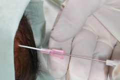 puncion-ventricular-2004-005