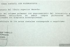 raquitismo-dbp-atelectasia-lobulo-sup-der-puntos-de-contencion-herida-abd-2005-001
