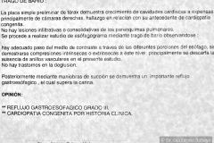 reflujo-gastroesofagico-rge-iii-gamagrafia-positiva-2000-005