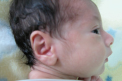 rinon-poliquistico-4d-y-postop-2005-000