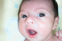 rinon-poliquistico-4d-y-postop-2005-001