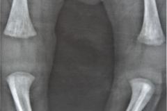 rubeola-congenita-enfermedad-radiolucida-osea-estrias-laminares-femur-1990-003