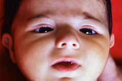 rubinstein-taybi-8m-000