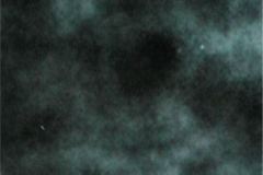 signo-de-la-carrilera-enterocolitis-001